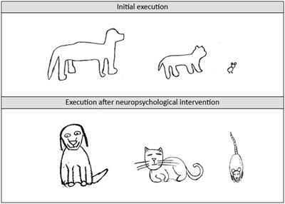 Clinical experiences of intervention of neurodevelopmental disorders and difficulties in school learning from historical-cultural neuropsychology